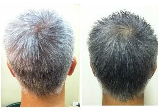 After