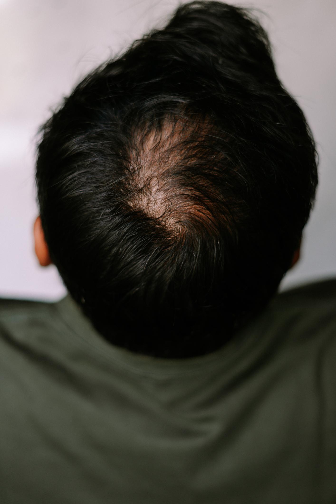Before penggunaan produk rambut