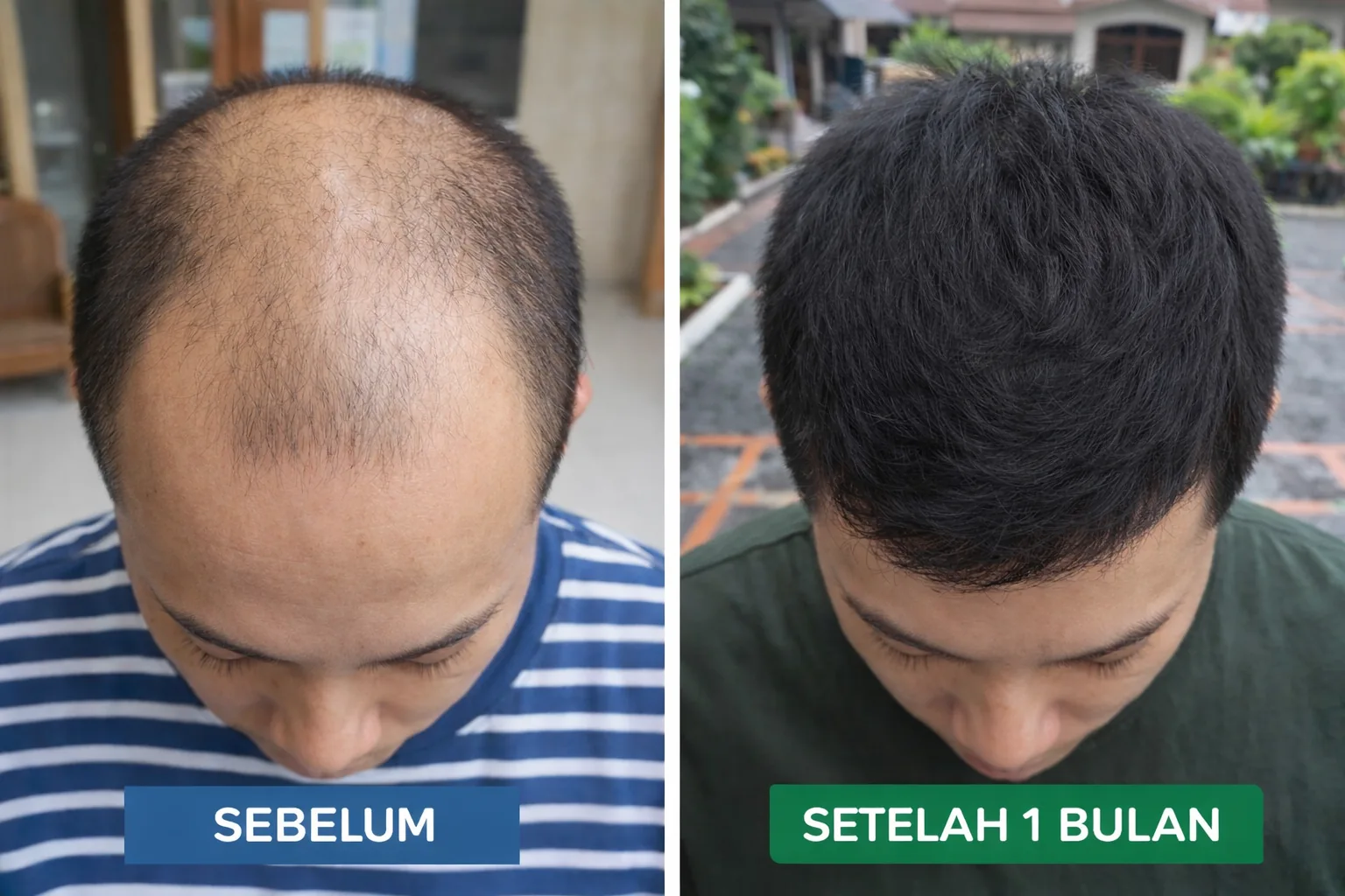Hasil Before After