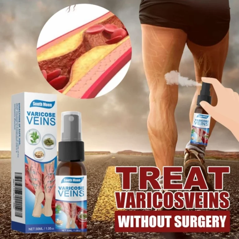 Kaki Varises