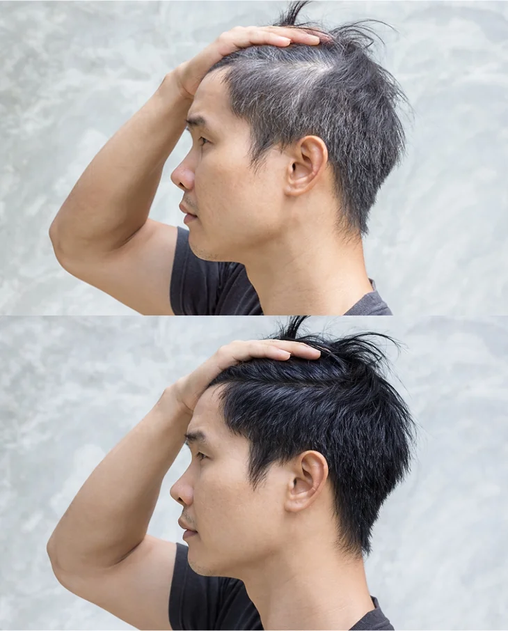 RAMBUT HITAM = KELIHATAN LEBIH MUDA 5-10 TAHUN!