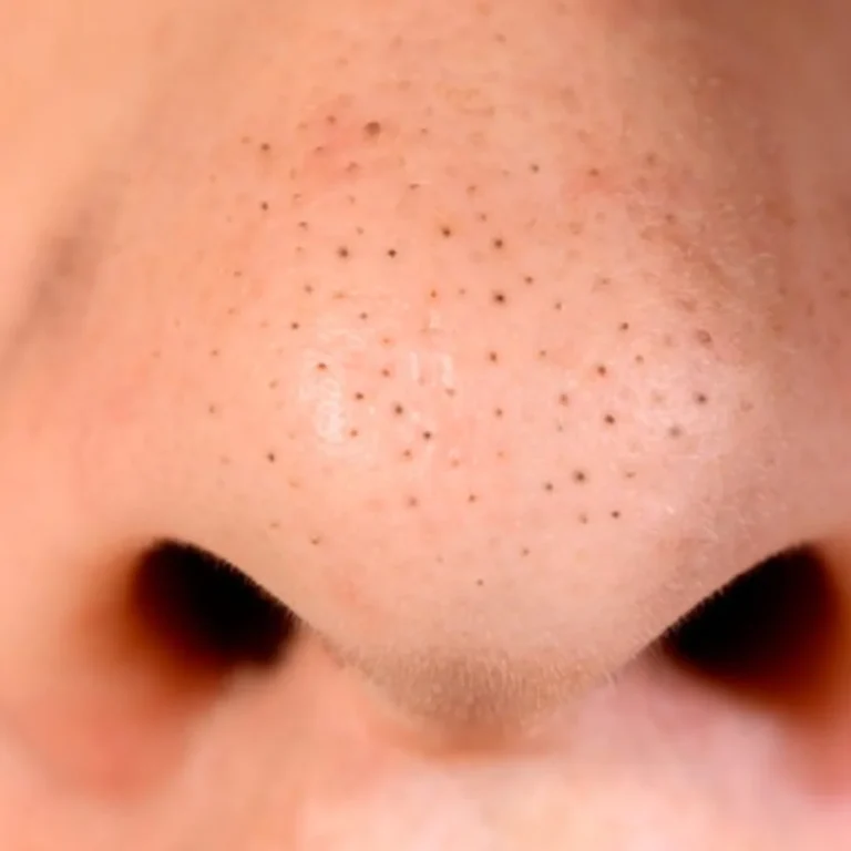 nose_1080x1080